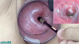 Mature Milf Cervix Play with Endoscope Japanese Cam into Uterus